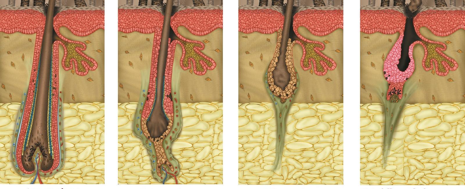 The first phase of human hair growth is called anagen which is the active growing stage that lasts anywhere from 2 7 years generally 80 85 of the hair on a human head is in this phase and any given time