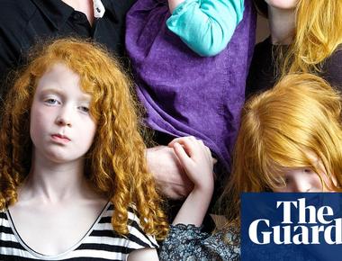 Scotland has the most redheads