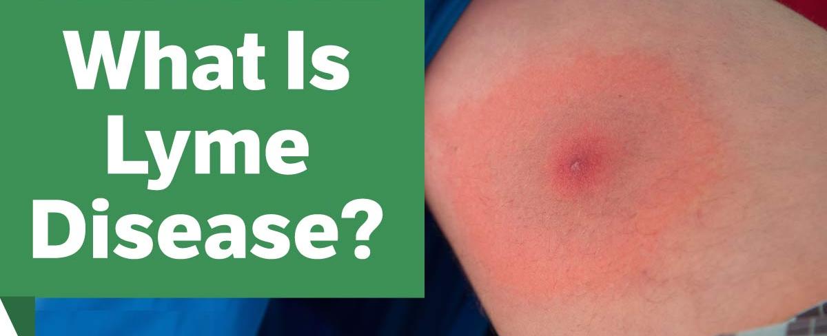 Lyme disease is named after the town of lyme connecticut where several cases were identified in 1975