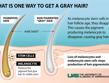 Gray hair is caused by a reduction of pigment while white hair has no pigment at all