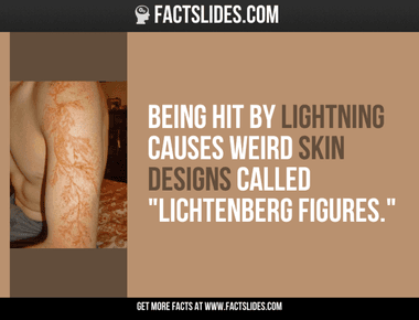 Being hit by lightning causes weird skin designs called lichtenberg figures