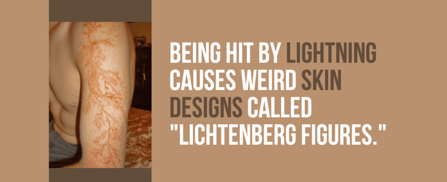 Being hit by lightning causes weird skin designs called lichtenberg figures