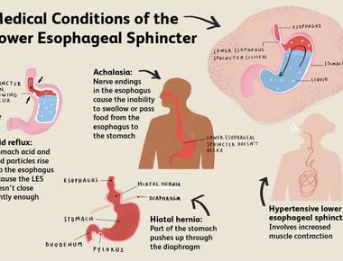 The sound made by farting is determined by the tightness of the sphincter muscle as well as the amount of pressure expelling the gas from the body