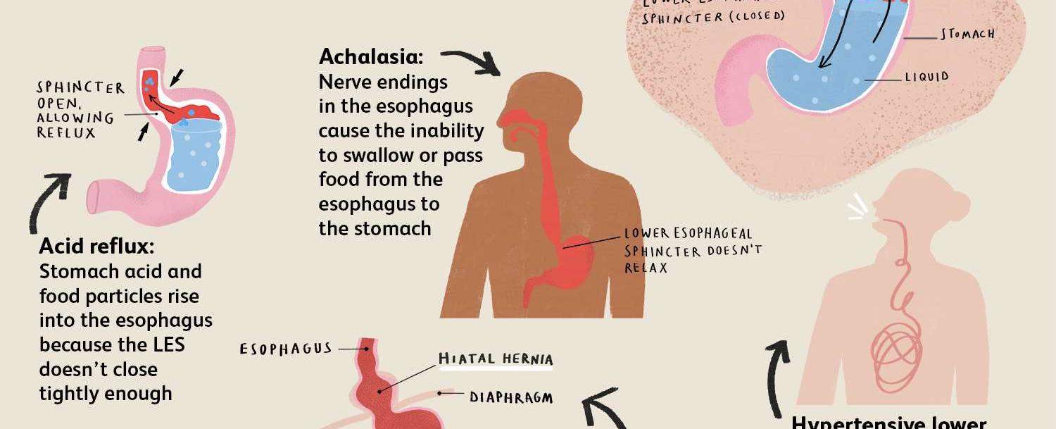 The sound made by farting is determined by the tightness of the sphincter muscle as well as the amount of pressure expelling the gas from the body