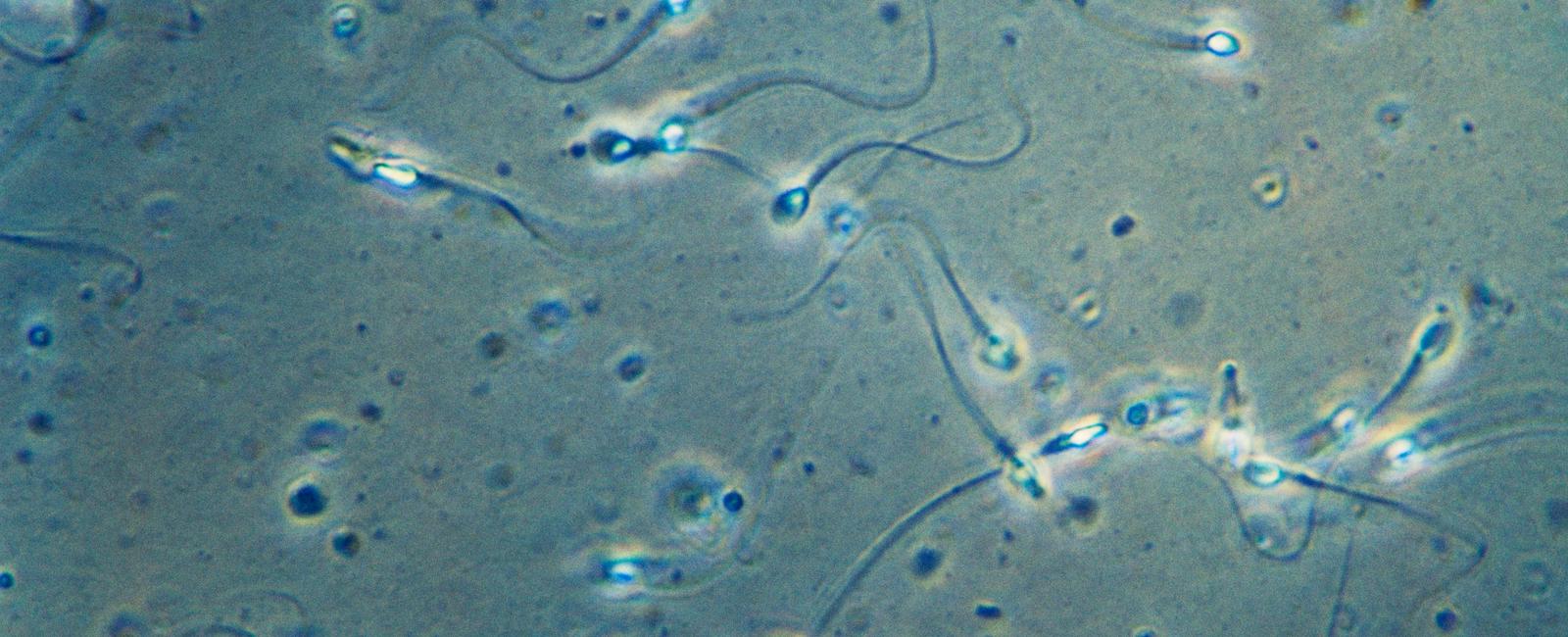 Sperm cells can live for up to 30 hours after a man has died the sperm can be gathered and used for posthumous fertilization